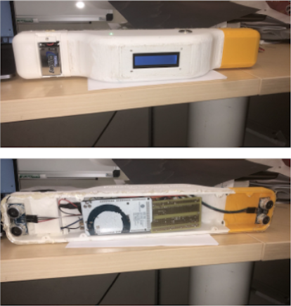 Ultrasonic Stadiometer